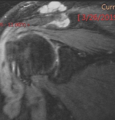 Figure 1 for case Gout ( RID3567 )
